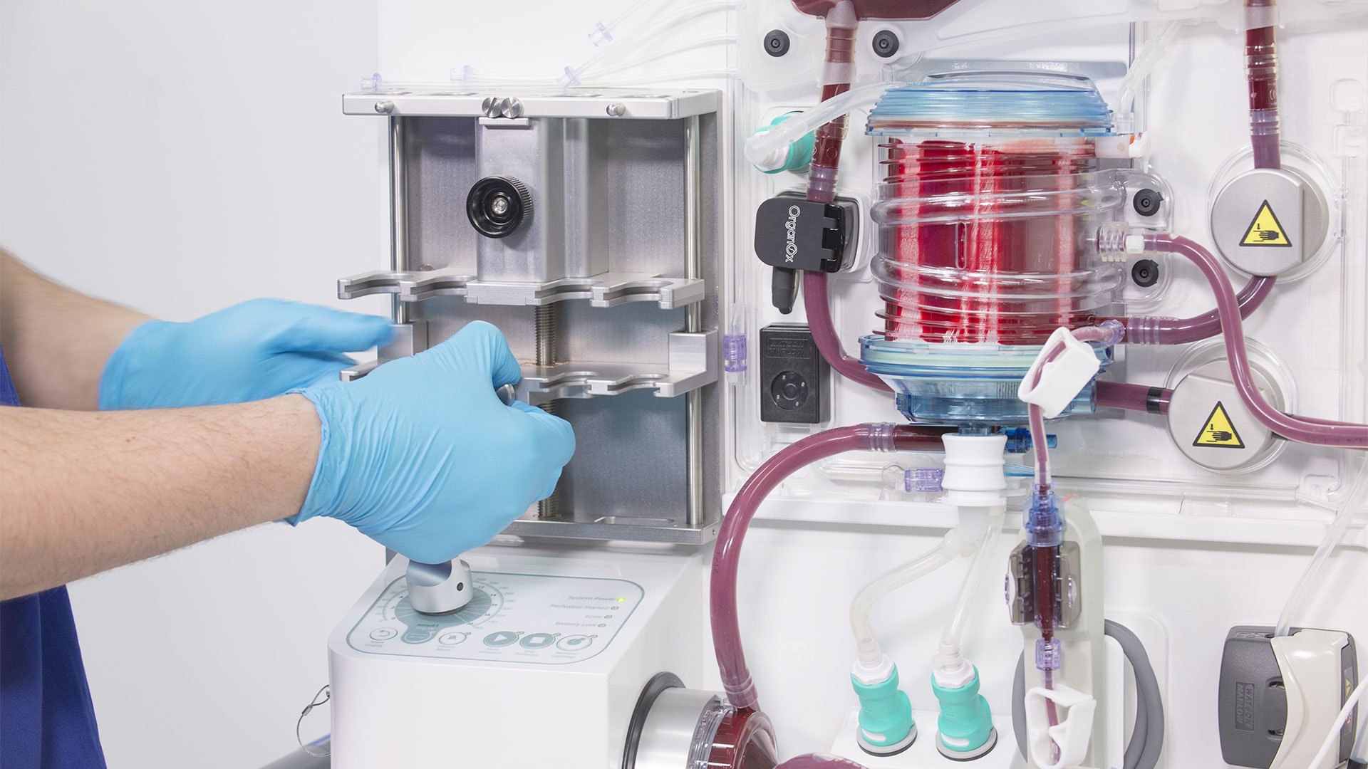 Lauxera Capital Partners Co-Leads a $142m Equity Investment Into OrganOx