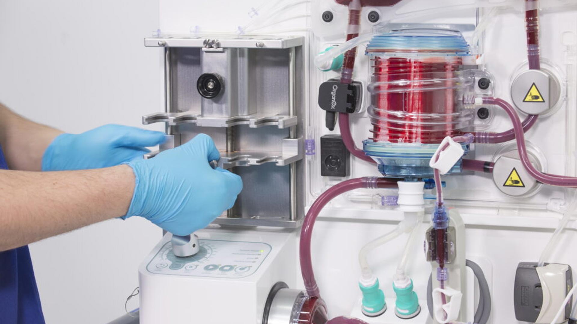 Terumo to acquire OrganOx Limited, a leading innovator in organ preservation devices, marking strategic entry into the organ transplantation-related sector