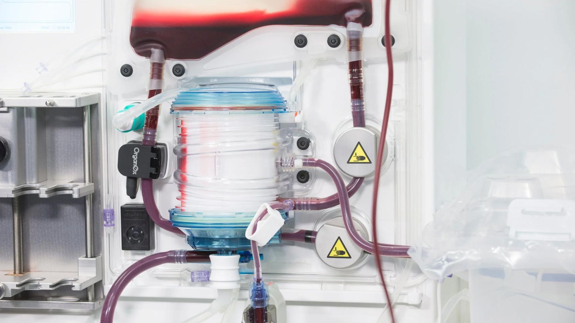 Terumo to acquire Organox Limited for approximately USD $1.5 billion